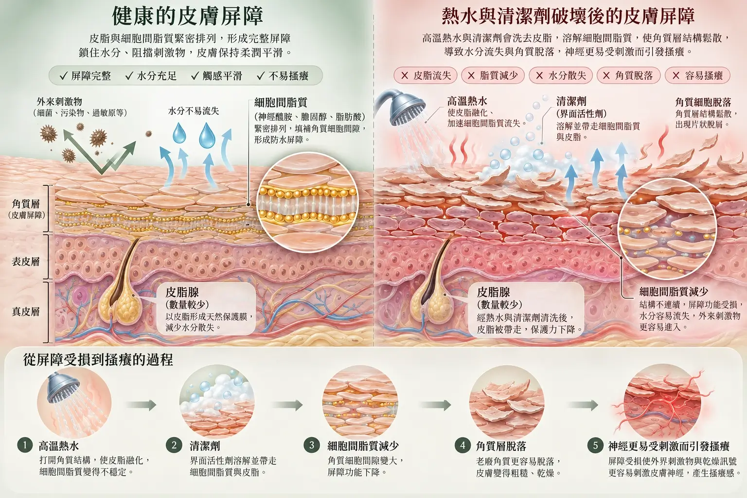 熱水清潔前後的皮膚角質層與脂質屏障示意