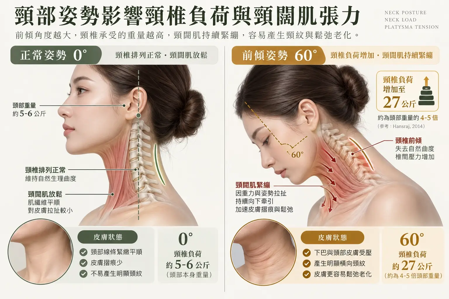 內文圖 01｜平視與低頭姿勢之頸部生物力學比較